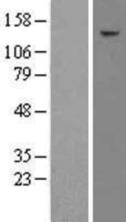 Novus Biologicals&trade;&nbsp;TAF2 Overexpression Lysate
