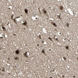 TAF5 Antibody, Novus Biologicals 0.1mL; Unlabeled:Antibodies, Polyclonal