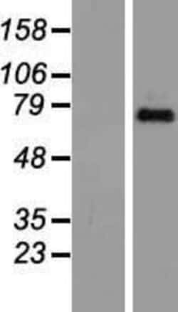 Novus Biologicals&trade;&nbsp;TAF6 Overexpression Lysate
