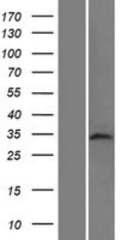 Novus Biologicals™ TAF8 Overexpression Lysate
