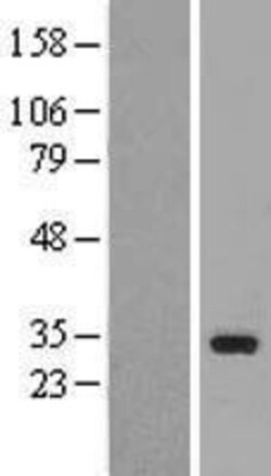 Novus Biologicals&trade;&nbsp;TAF9b Overexpression Lysate