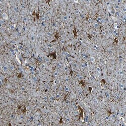 TAFA1/FAM19A1 Antibody, Novus Biologicals 0.1mL; Unlabeled:Antibodies,