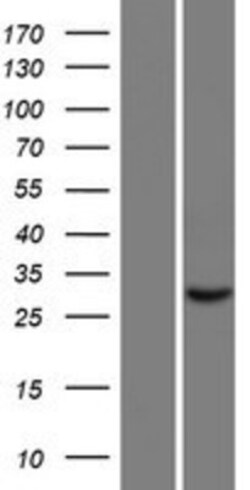 Novus Biologicals™ TAGAP Overexpression Lysate
