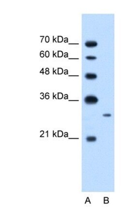 TAK1L Antibody, Novus Biologicals:Antibodies:Primary Antibodies
