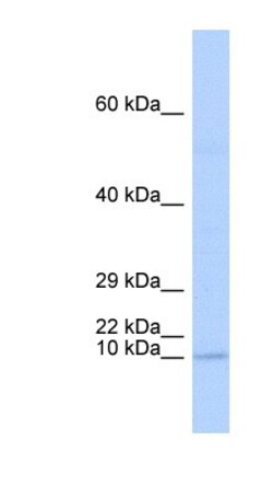 TAL2 Antibody, Novus Biologicals 100&mu;L; Unlabeled:Antibodies, Polyclonal