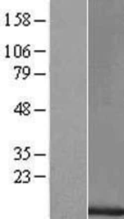 Novus Biologicals&trade;&nbsp;TAL2 Overexpression Lysate