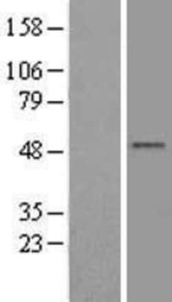 Novus Biologicals&trade;&nbsp;TANK Overexpression Lysate