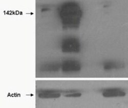 Tankyrase 1 Antibody, Novus Biologicals 0.1mg; Unlabeled:Antibodies, Polyclonal