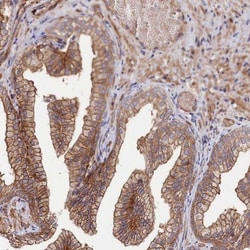 Tankyrase binding protein 1 Antibody, Novus Biologicals 0.1mL; Unlabeled:Antibodies,