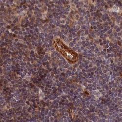 Tankyrase binding protein 1 Antibody, Novus Biologicals 0.1mL; Unlabeled:Antibodies,