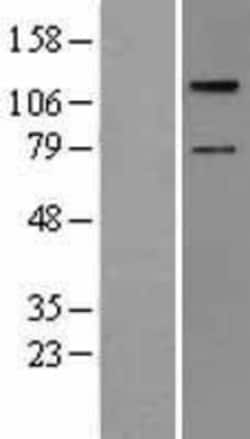 Novus Biologicals™ TAO2 Overexpression Lysate