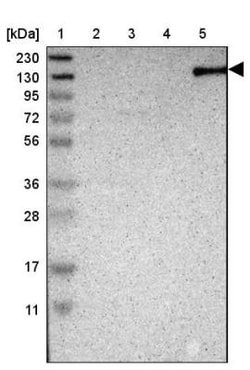 TAO2 Antibody, Novus Biologicals 0.1mL; Unlabeled:Antibodies