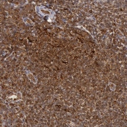 TAP2 Antibody, Novus Biologicals 0.1mL; Unlabeled:Antibodies, Polyclonal