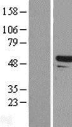 Novus Biologicals&trade;&nbsp;TAPBPR Overexpression Lysate