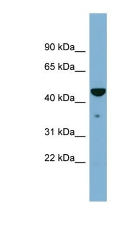 Tapasin Antibody, Novus Biologicals:Antibodies:Primary Antibodies