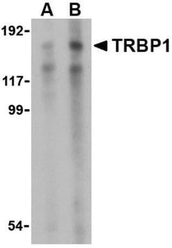 TARBP1 Antibody - BSA Free, Novus Biologicals 0.1mg; Unlabeled:Antibodies,