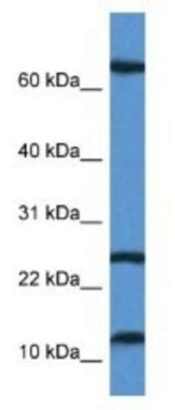 TARP Antibody, Novus Biologicals:Antibodies:Primary Antibodies