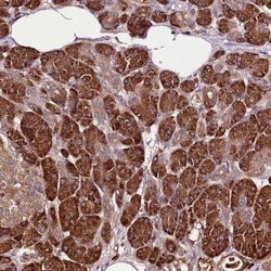 TARS Antibody, Novus Biologicals:Antibodies:Primary Antibodies