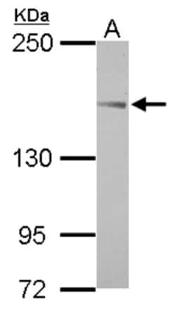 anti-TARSH, Polyclonal, Novus Biologicals 0.1mL; Unlabeled:Antibodies,