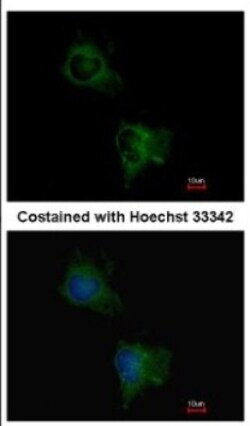 TAS1R1 Antibody, Novus Biologicals 0.1mL; Unlabeled:Antibodies, Polyclonal