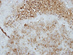 TAS1R1 Antibody, Novus Biologicals 0.1mL; Unlabeled:Antibodies, Polyclonal
