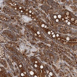 TAS1R1 Antibody, Novus Biologicals 25 &mu;L; Unlabeled:Antibodies, Polyclonal