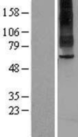Novus Biologicals™ TAS1R2 Overexpression Lysate