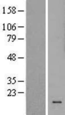 Novus Biologicals&trade;&nbsp;TAS2R13 Overexpression Lysate