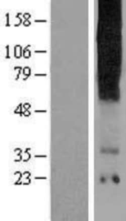 Novus Biologicals™ TAS2R16 Overexpression Lysate