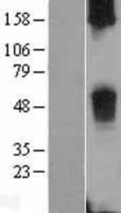 Novus Biologicals&trade;&nbsp;TAS2R38 Overexpression Lysate