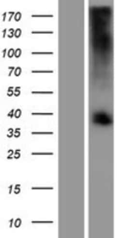 Novus Biologicals™ TAS2R39 Overexpression Lysate