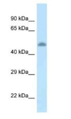 TAT Antibody, Novus Biologicals 100&mu;L; Unlabeled:Antibodies, Polyclonal
