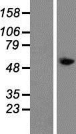 Novus Biologicals&trade;&nbsp;TAT Overexpression Lysate