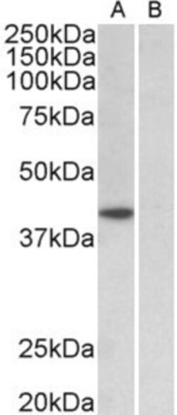 TATA binding protein TBP Antibody, Novus Biologicals 0.1 mg | Buy Online | Novus Biologicals | Fisher Scientific