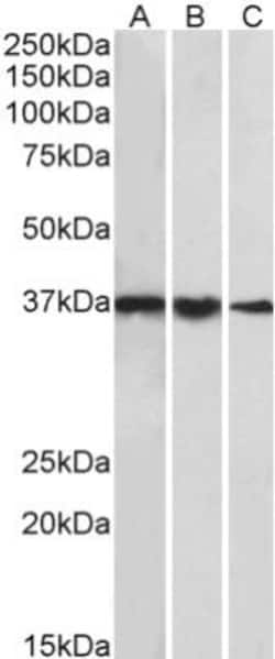 TATA binding protein TBP Antibody, Novus Biologicals 0.1 mg | Buy Online | Novus Biologicals | Fisher Scientific