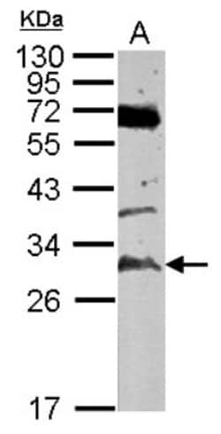 TATDN3 Antibody, Novus Biologicals 0.1mL; Unlabeled:Antibodies, Polyclonal