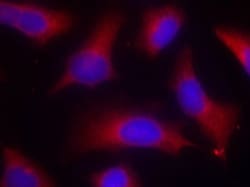 Tau, p Ser262 Antibody, Novus Biologicals 0.05 mg; Unconjugated:Antibodies,