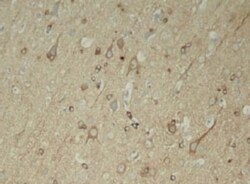 Tau, p Ser396 Antibody, Novus Biologicals:Antibodies:Primary Antibodies