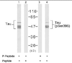 Tau, p Ser396 Antibody, Novus Biologicals:Antibodies:Primary Antibodies