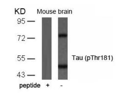 Tau, p Thr181 Antibody, Novus Biologicals:Antibodies:Primary Antibodies