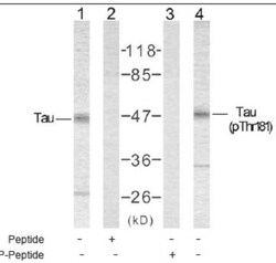Tau, p Thr181 Antibody, Novus Biologicals:Antibodies:Primary Antibodies