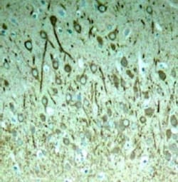 Tau, p Thr231 Antibody, Novus Biologicals 0.025 mL; Unconjugated:Antibodies,