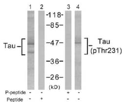 Tau, p Thr231 Antibody, Novus Biologicals 0.025 mL; Unconjugated:Antibodies,