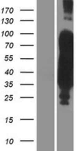 Novus Biologicals™ Tau Overexpression Lysate