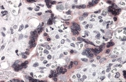 Tau tubulin kinase 2 Antibody - BSA Free, Novus Biologicals 0.1mg; Unlabeled:Antibodies,