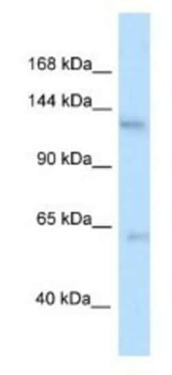 Tau tubulin kinase 2 Antibody, Novus Biologicals:Antibodies:Primary Antibodies