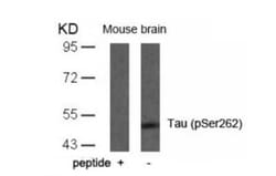 Tau, p Ser262 Antibody, Novus Biologicals 0.05 mg; Unconjugated:Antibodies,