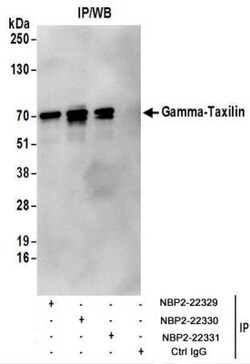 taxilin gamma Antibody, Novus Biologicals 0.1mg; Unlabeled:Antibodies,