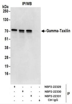 taxilin gamma Antibody, Novus Biologicals 0.1mg; Unlabeled:Antibodies,