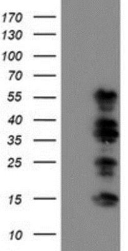 TAZ/WWTR1 Antibody (OTI1H9), Novus Biologicals 0.1mL; Unlabeled:Antibodies,